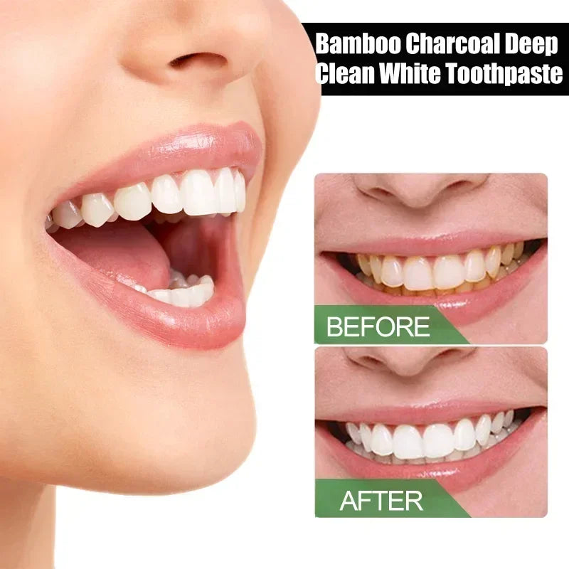 Bamboo charcoal deep tooth whitening toothpaste cleaning yellow teeth stains Tartar removes mouth odor bright white oral care